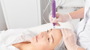 benefits of microneedling